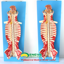 MUSCLE17(12311) Medical Education Use Spinal Canal Anatomy Model 12311